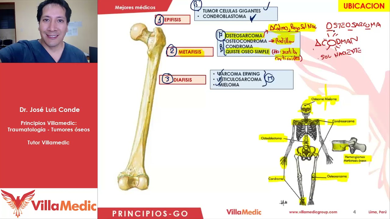 Principios Villamedic  - Traumatología -  Tumores óseos