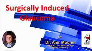 Surgically Induced Glaucoma