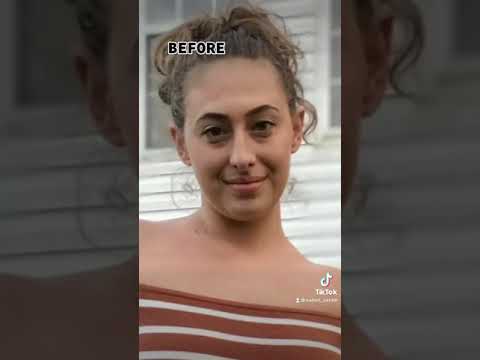 Say goodbye to under eye bags and dark circles!