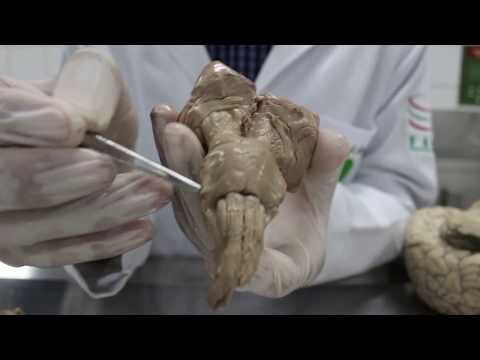 BULBO | Tronco Encefálico – Neuroanatomia