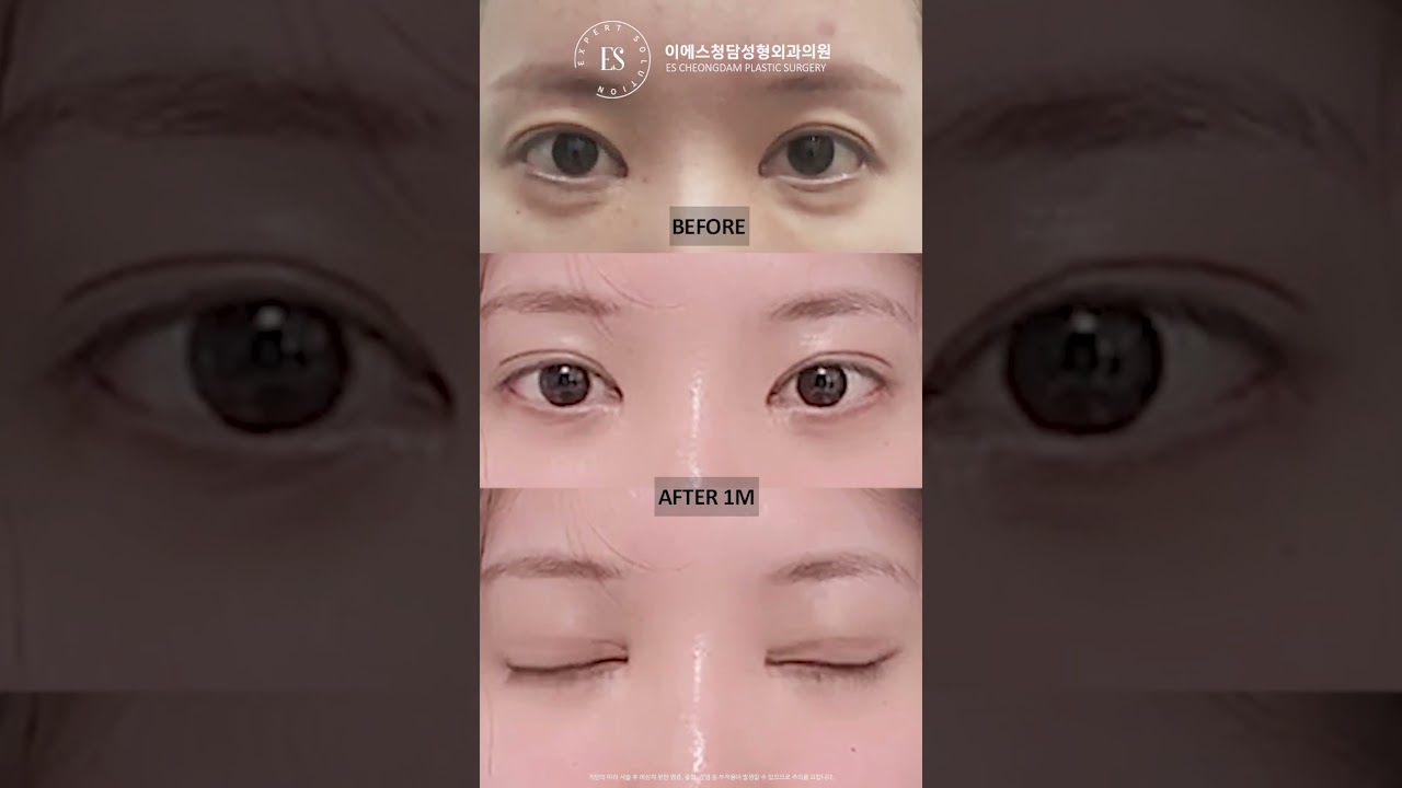 이에스 유튜브