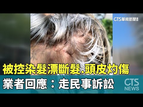 被控染髮漂斷髮.頭皮灼傷　業者回應：走民事訴訟