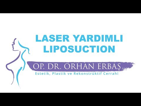 Laser Yardımlı Liposuction