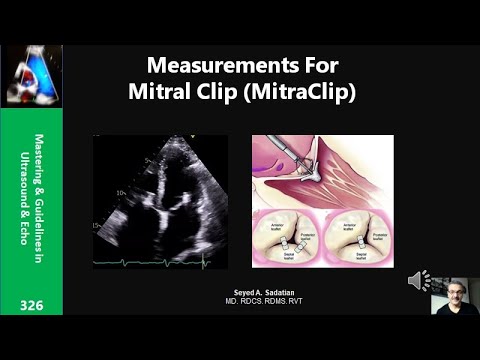 Measurements For Mitral Clip