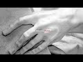 The National - Graceless (Live in Rome)