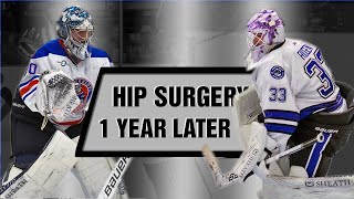 FAI Cam Hip Surgery 1 Year Later... MY Experience