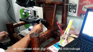 Download lagu DI ZOOM 1000X beginilah makhluk di dalam sikat gigi mp3 Download lagu DI ZOOM 1000X beginilah makhluk di dalam sikat gigi mp3