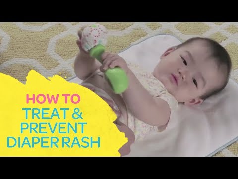How To Treat &amp; Prevent Diaper Rash | Best For Baby