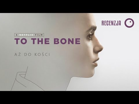 Chirurgia dla koślawego zniekształcenia stopy Deformacja stóp w skoliozy