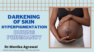 Darkening of Skin or Hyperpigmentation During Pregnancy | Dr Monika Agrawal