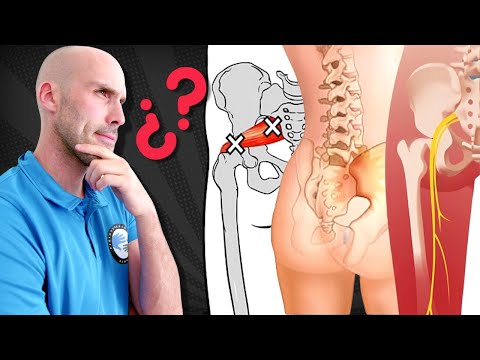¿CIÁTICA O FALSA CIÁTICA? test y consejos para saber donde se origina la ciatica