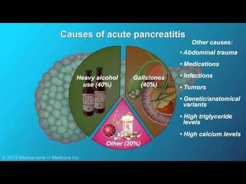 Acute Pancreatitis
