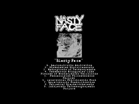 Nasty Face - Blasty Face FULL EP (2016 - Goregrind)