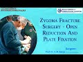 Zygoma Fracture Surgery - Open Reduction and Plate Fixation