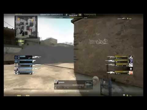 my hairline is receding