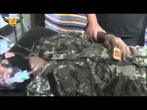 اصابة القائد الميداني لكتيبة الشهيد حمزة الزعبي بغازات سامة في درعا السد