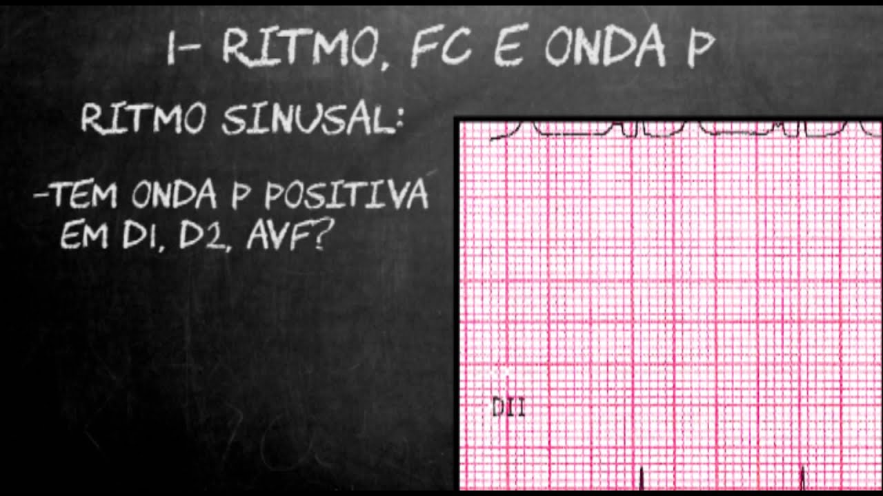 Avaliação do Eletrocardiograma em 5 passos