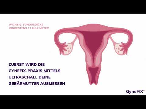 Kupferkette GyneFix® als hormonfreie Verhütung in Berlin-Frauenärzte am Potsdamer Platz