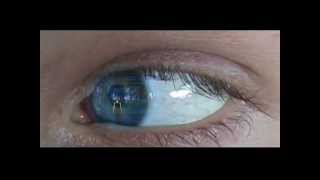 Video 6