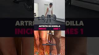 Así se ve una rehabilitación de artritis de rodilla #fisioterapia