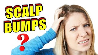 Why Do I Have Bumps on My Scalp | How To Get Rid of Scalp Acne & Folliculitis