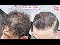 Most Wanted WIN KERATIN PRODUCT  CURLY TO STRAIGHT HAIR KERATIN TREATMENT  HAIR STRAIGHTENING MEN HAIRSTYLES , Video Soft Keratin Treatment for Curly Hair most searching!