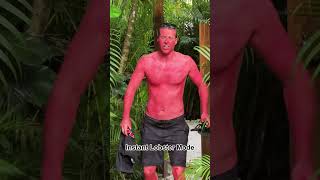 Download lagu You Forgot Sunscreen 💀☀️#sunburn #summerfail #beachfail #funnyvideos#viralvideos mp3 Download lagu You Forgot Sunscreen 💀☀️#sunburn #summerfail #beachfail #funnyvideos#viralvideos mp3