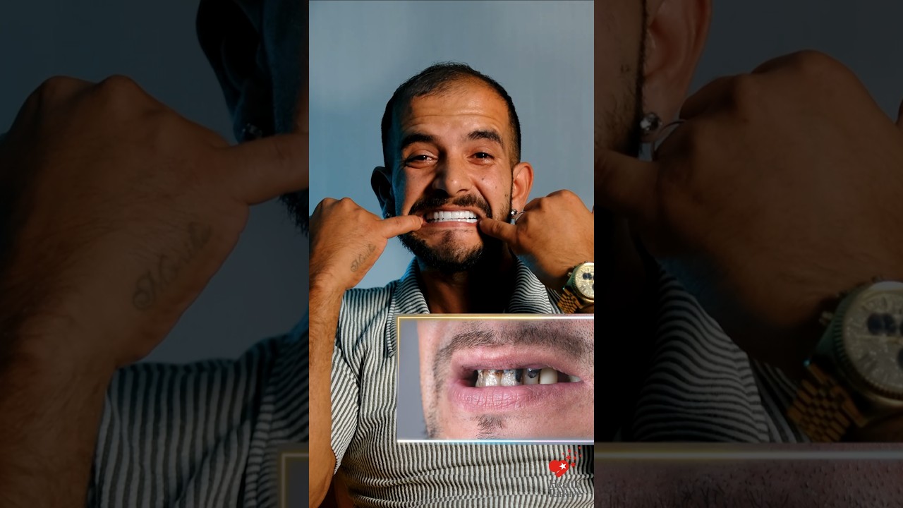 Временная корона - Video