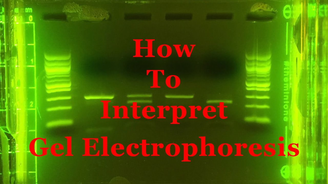 Interpreting Gel Epectrophoresis