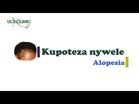, title : 'Kupoteza nywele'