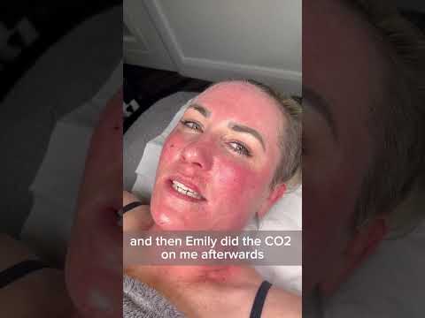 Changes Clinic - Secret Pro