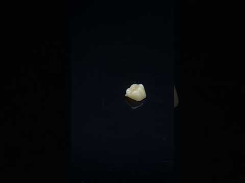 YouTube 썸네일