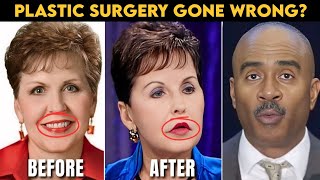 JOYCE MEYER'S PLASTIC SURGERY DISASTER Gets WORSE-GINO Jennings RESPONSE Had Everyone LAUGHING😛