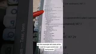 How to find the ICD-10-CM Code For: Tachycardia