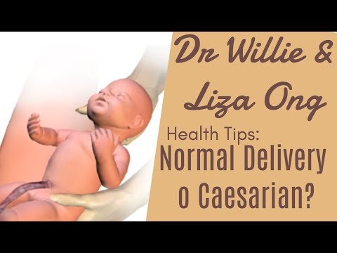 Review sa slimming diets Na nawala sa baywang bago at pagkatapos ng mga larawan