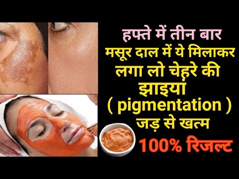 पुरानी से पुरानी झाइयां ( pigmentation ) दाग धब्बे जड़ से खत्म करके चेहरे को गोरा बनाएं