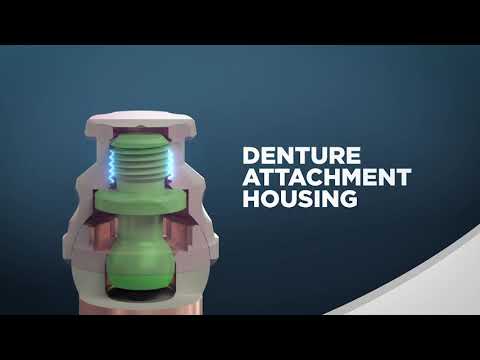 LOCATOR F-Tx — Reduced Chair Time & Simplified Maintenance