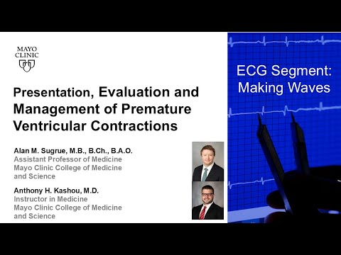Presentation, Evaluation, and Management of Premature Ventricular Contractions