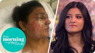 The Aspiring Model Scarred for Life in an Unprovoked Acid Attack | This Morning video