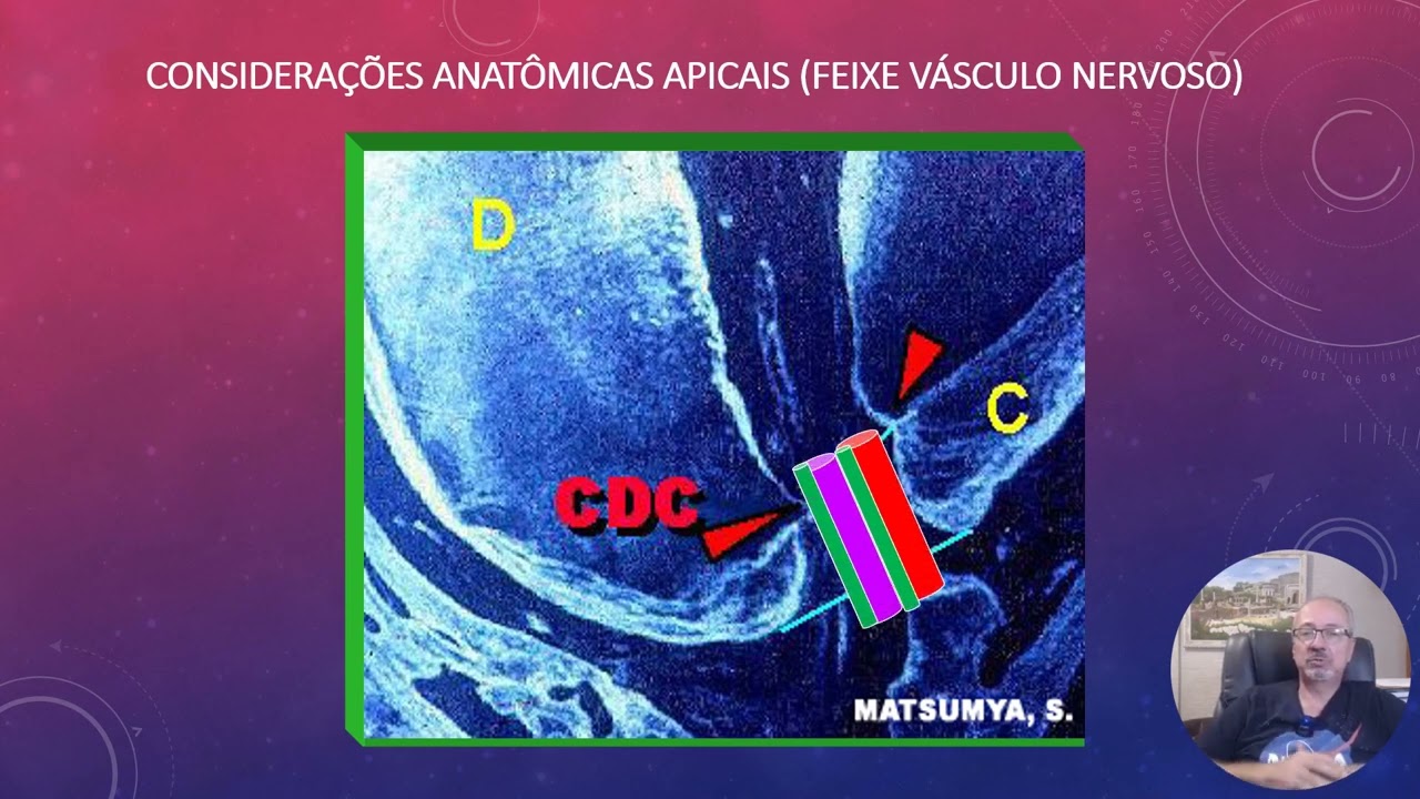 TRAUMATISMO DENTO-ALVEOLAR GRADUAÇÃO