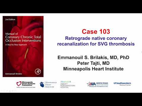 Case 103: Manual of CTO Interventions: CTO recanalization for SVG thrombosis