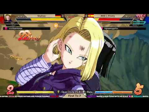 THE HARDEST READ TO BAIT SPARK!!!!