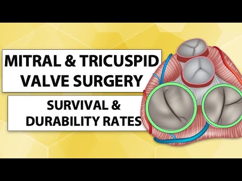 Surgeon Q&A: Mitral and Tricuspid Valve Surgery Survival & Durability with Dr. Robert Smith