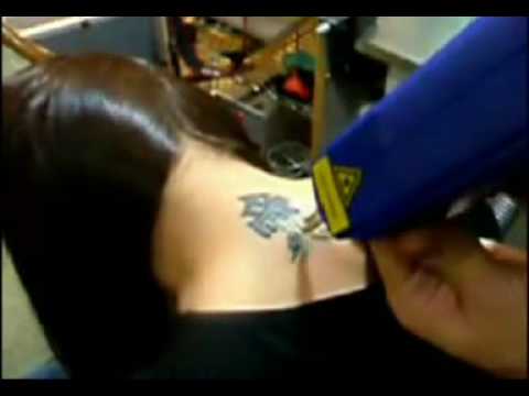 Dove comprare la crema da pigmentary nota akhromin Lentiggini di faccia dallinfanzia