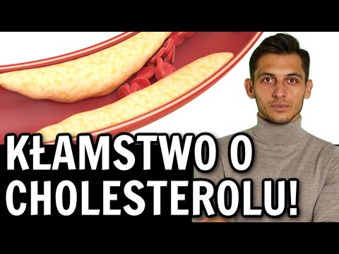 Total cholesterol, LDL, HDL - the norms are a lie! 🤯 New and correct cholesterol norms! Szemraj