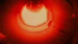 scar symmetry - abstracted