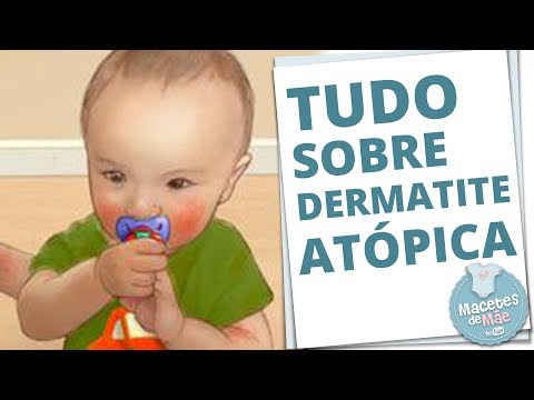 La Roche a una posa lipikar balsamo risposte di AP a dermatite atopic Sanatorio di psoriasi Elton
