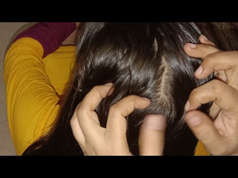 Remove many lice from brown hair/Nit picking full Vedio/daily routine Vlogs Vlog by