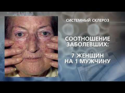Признаки защемления нервов в грудном отделе Помощь при боли в локтевом суставе
