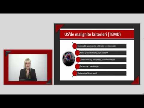 US'de malignite kriterleri